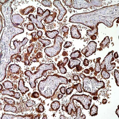 آنتی بادی HCG(Chorionic Gonadotropin) کلون Polyclonal برند PathoSage