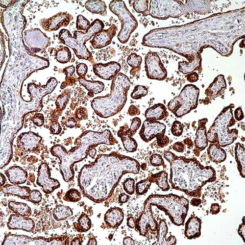 آنتی بادی HCG(Chorionic Gonadotropin) کلون Polyclonal برند PathoSage