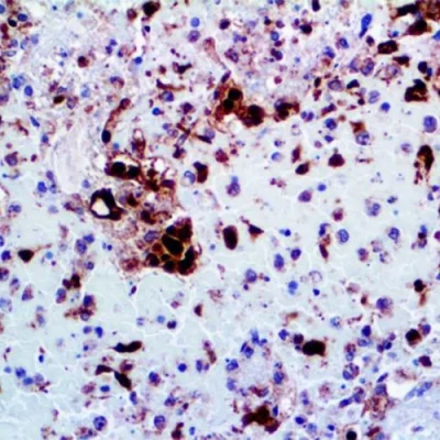آنتی بادی Herpes Simplex Virus 2 کلون Polyclonal برند PathoSage