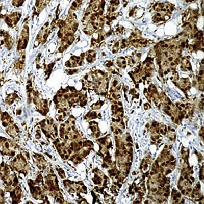 آنتی بادی HSP70(Heat Shock Protein 70) کلون W27 برند PathoSage
