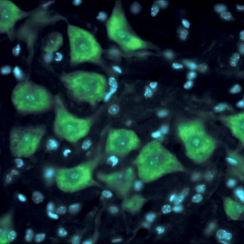 آنتی بادی HuC/HuD Neuronal Protein کلون 16A11 برند PathoSage