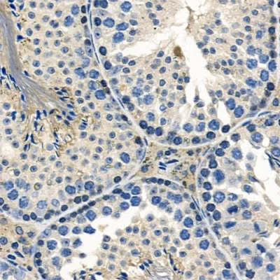 آنتی بادی Human Herpes Virus 1+2 کلون Polyclonal برند PathoSage