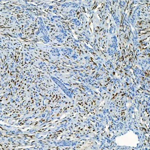 آنتی بادی Human Herpes Virus 8 کلون 13B10 برند PathoSage