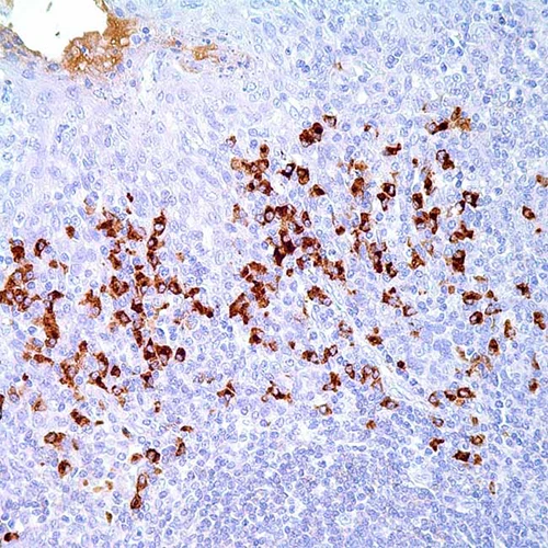 آنتی بادی Human IgD کلون Polyclonal برند PathoSage