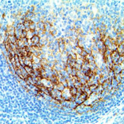 آنتی بادی Human IgE کلون Polyclonal برند PathoSage