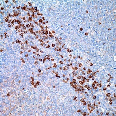 آنتی بادی Human IgG کلون E20-V برند PathoSage