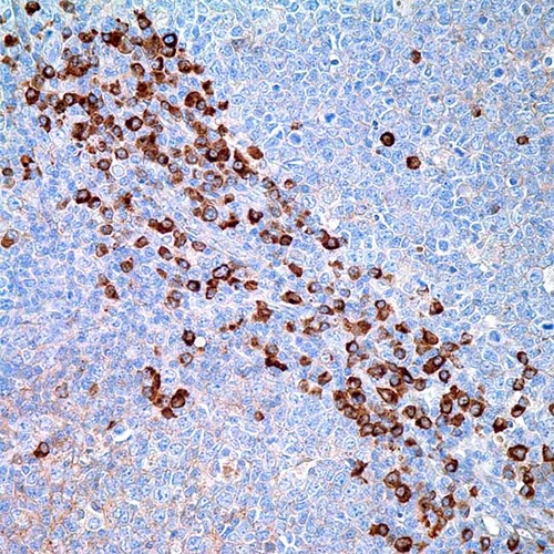 آنتی بادی Human IgG کلون E20-V برند PathoSage