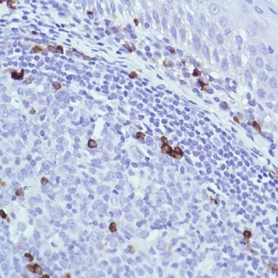 آنتی بادی Immunoglobulin J chain کلون SP105 برند PathoSage