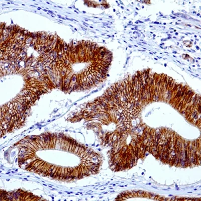 آنتی بادی Beta Catenin 1 کلون EP35 برند PathoSage