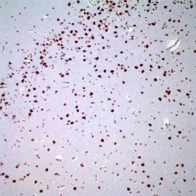 آنتی بادی INI1 کلون 25/BAF47 برند PathoSage