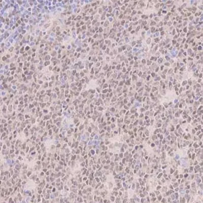 آنتی بادی IRF8 کلون EPR20441 برند PathoSage