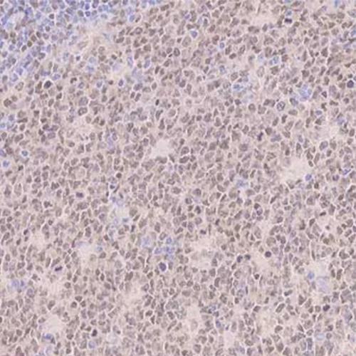 آنتی بادی IRF8 کلون EPR20441 برند PathoSage