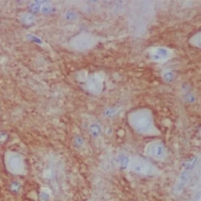 آنتی بادی L1CAM(Neural Cell Adhesion Molecule L1) کلون BSR3 برند PathoSage