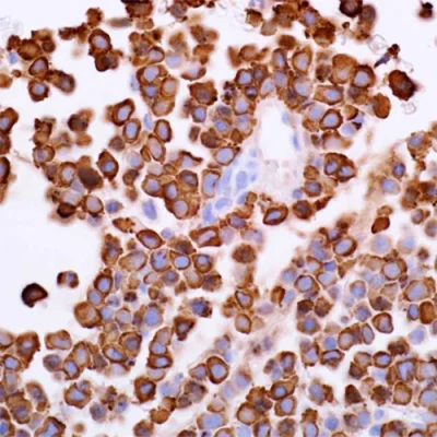 آنتی بادی Lambda Immunoglobulin Light Chain کلون EP172 برند PathoSage