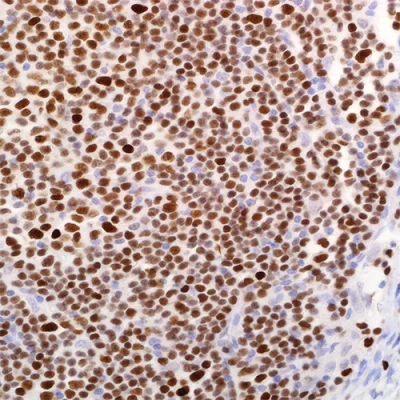 آنتی بادی LEF1(Lymphoid Enhancer-Binding Factor 1) کلون EP310 برند PathoSage