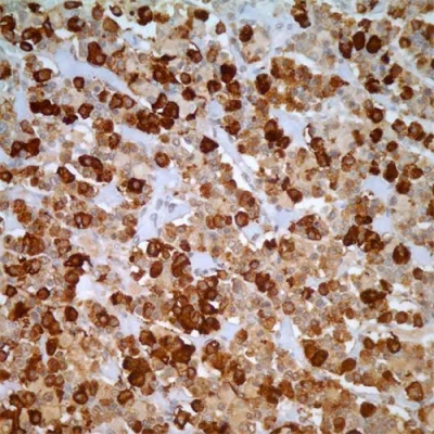 آنتی بادی LH(Luteinizing Hormone) کلون Polyclonal برند PathoSage