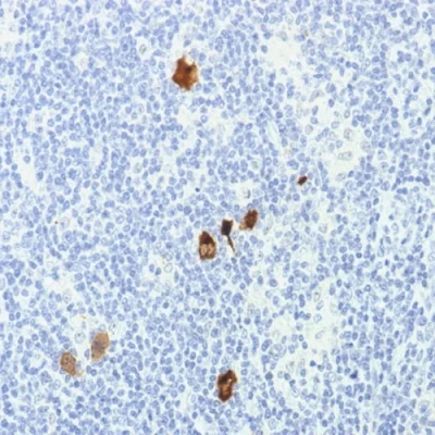 آنتی بادی LMP1(Epstein-Barr Virus) کلون CS1-4 برند PathoSage