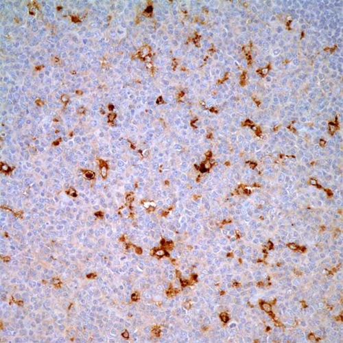 آنتی بادی Lysozyme کلون Polyclonal برند PathoSage