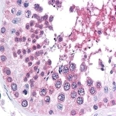 آنتی بادی BRG1 کلون EPNCIR111A برند PathoSage