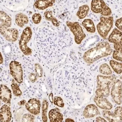 آنتی بادی Napsin A کلون BS10 برند PathoSage