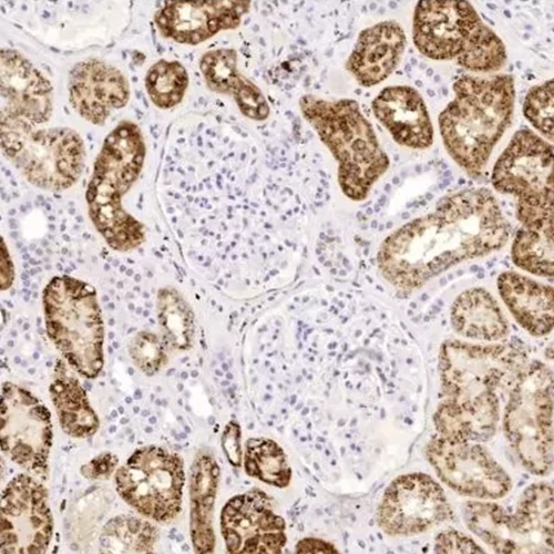 آنتی بادی Napsin A کلون BS10 برند PathoSage