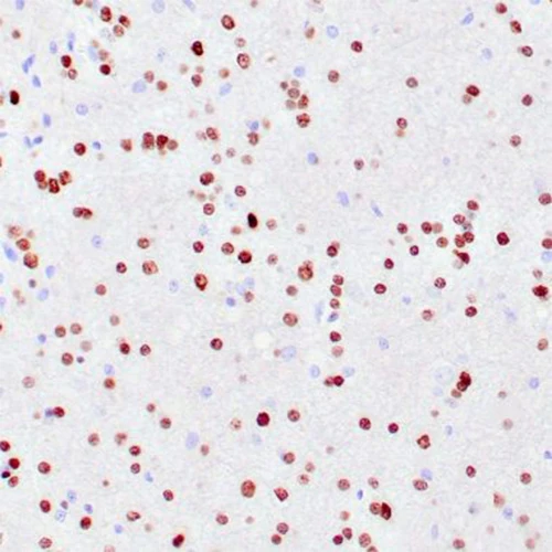 آنتی بادی NeuN Protein کلون A60 برند PathoSage