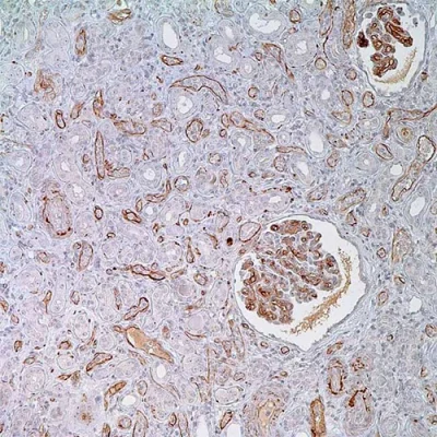 آنتی بادی C3d کلون Polyclonal برند PathoSage