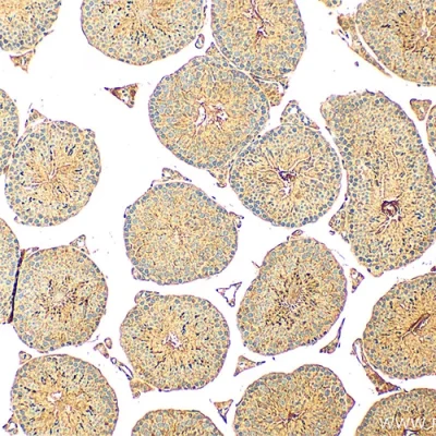 آنتی بادی Osteocalcin کلون G5 برند PathoSage