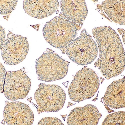 آنتی بادی Osteocalcin کلون G5 برند PathoSage