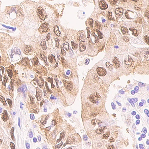 آنتی بادی P62 کلون 3/P62 LCK Ligand برند PathoSage