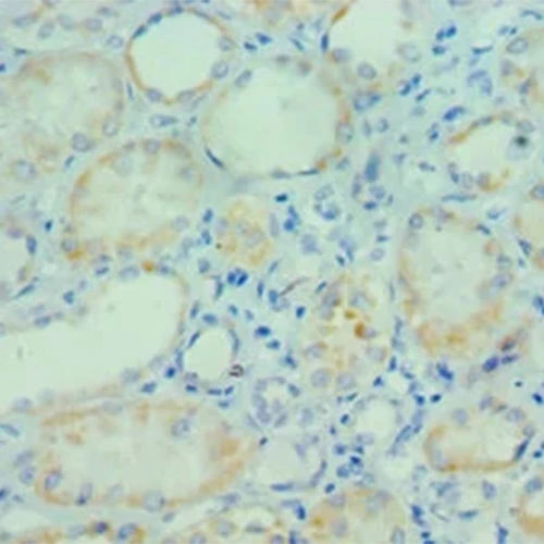 آنتی بادی Polymerase 1(ADP-Ribose/Poly) کلون Polyclonal برند PathoSage