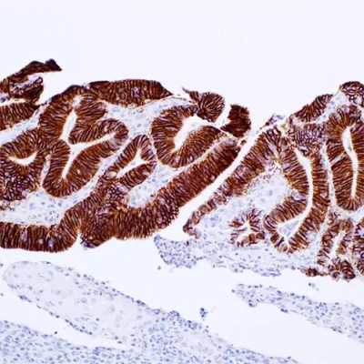 آنتی بادی Cadherin 17 کلون SP183 برند PathoSage