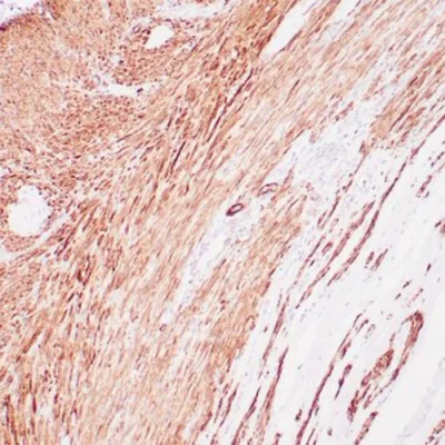 آنتی بادی Smooth Muscle Myosin, heavy chain کلون EP166 برند PathoSage