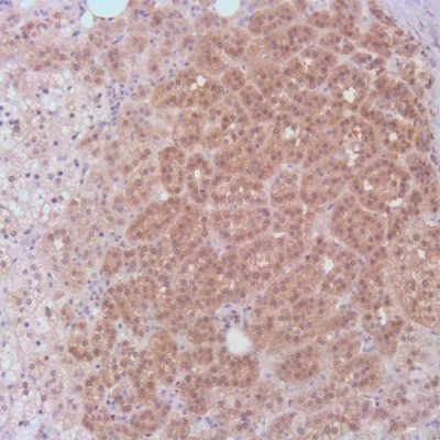 آنتی بادی Calretinin کلون BSR235 برند PathoSage