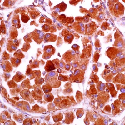 آنتی بادی Cathepsin K کلون 3F9 برند PathoSage