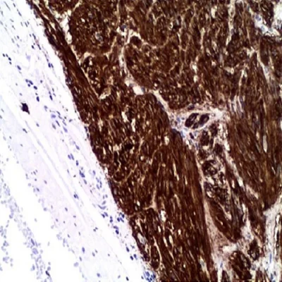 آنتی بادی CD117(c-kit) کلون EP10 برند PathoSage