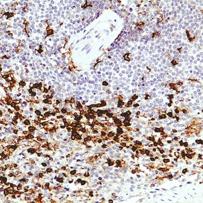آنتی بادی CD11b(Integrin Alpha-M) کلون EP45 برند PathoSage
