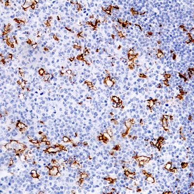 آنتی بادی CD11c(Integrin Alpha-X) کلون EP157 برند PathoSage