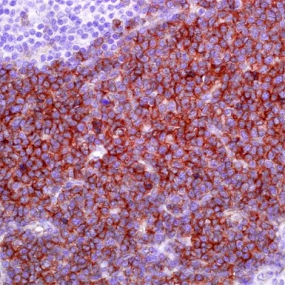 آنتی بادی CD123(Interleukin-3 Recepctor Alpha Chain) کلون 7G3 برند PathoSage