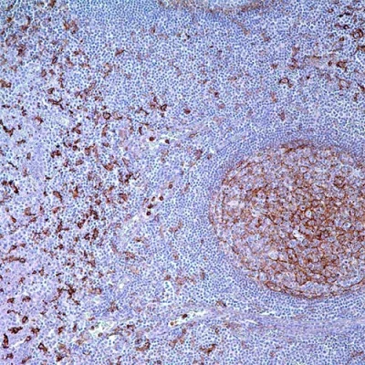 آنتی بادی CD14 کلون EP128 برند PathoSage