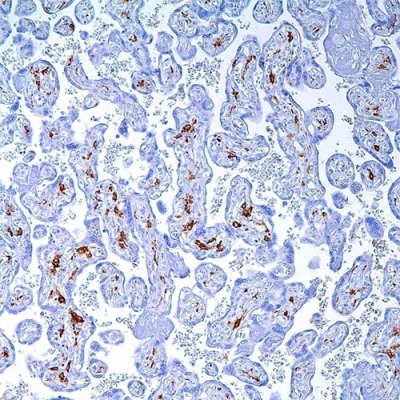 آنتی بادی CD163 کلون EP324 برند PathoSage