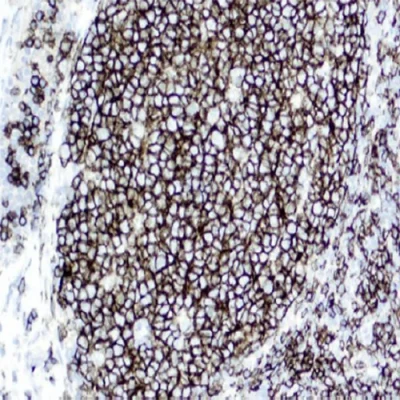 آنتی بادی CD19 کلون SP110 برند PathoSage