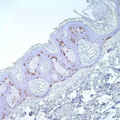 آنتی بادی CD1a کلون EP80 برند PathoSage