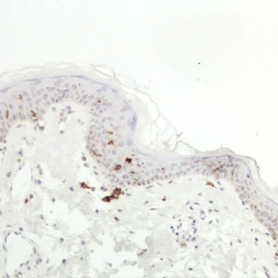 آنتی بادی CD207(Langerin) کلون EPR15863 برند PathoSage