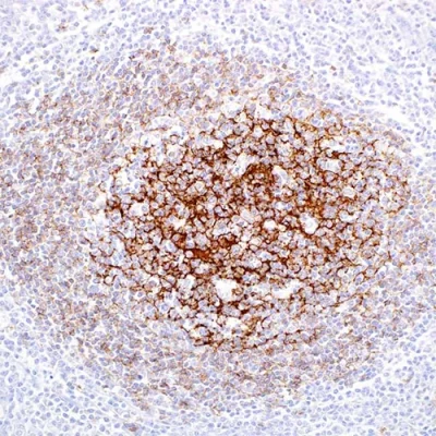 آنتی بادی CD23 کلون SP23 برند PathoSage