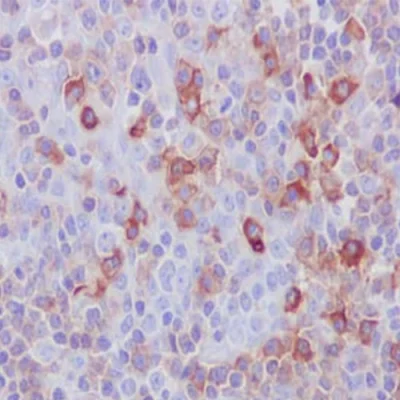 آنتی بادی CD27 کلون EPR8569 برند PathoSage
