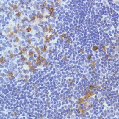 آنتی بادی CD278 کلون SP98 برند PathoSage