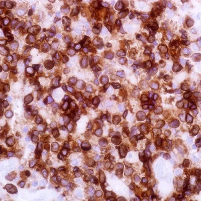 آنتی بادی CD3 کلون EP41 برند PathoSage