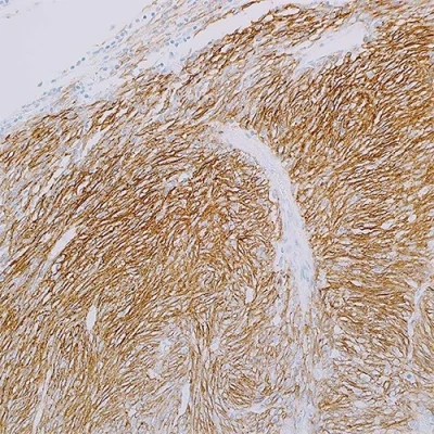 آنتی بادی CD35 کلون EP197 برند PathoSage