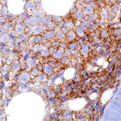 آنتی بادی CD38 کلون 38C03 برند PathoSage